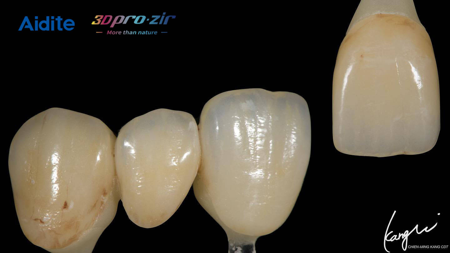 马桶蹦瓷(马桶内掉瓷如何修补)